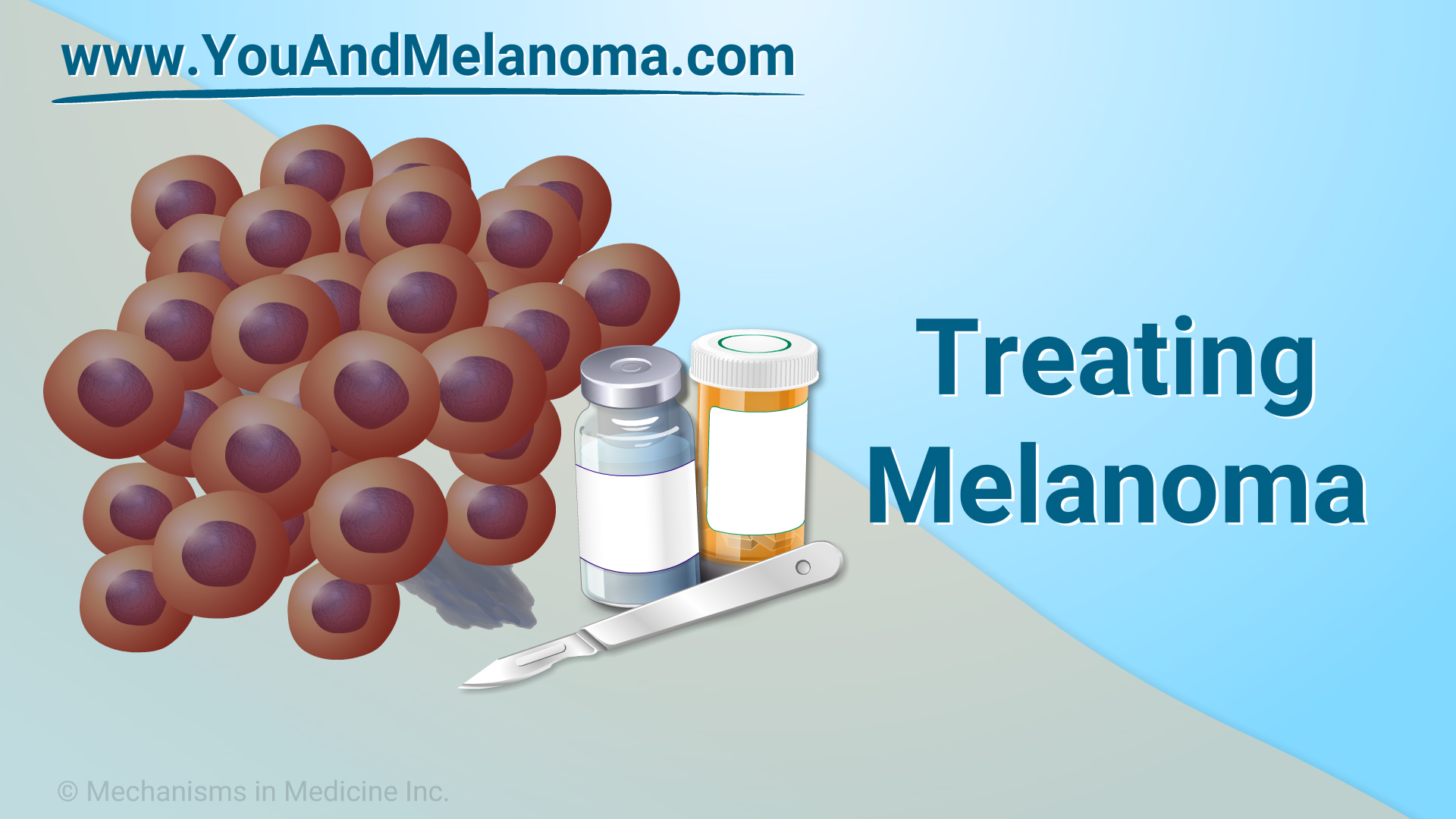 treating melanoma